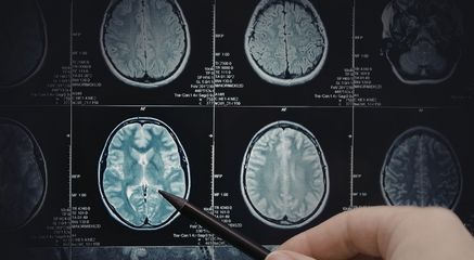 Role of Diagnostic Imaging